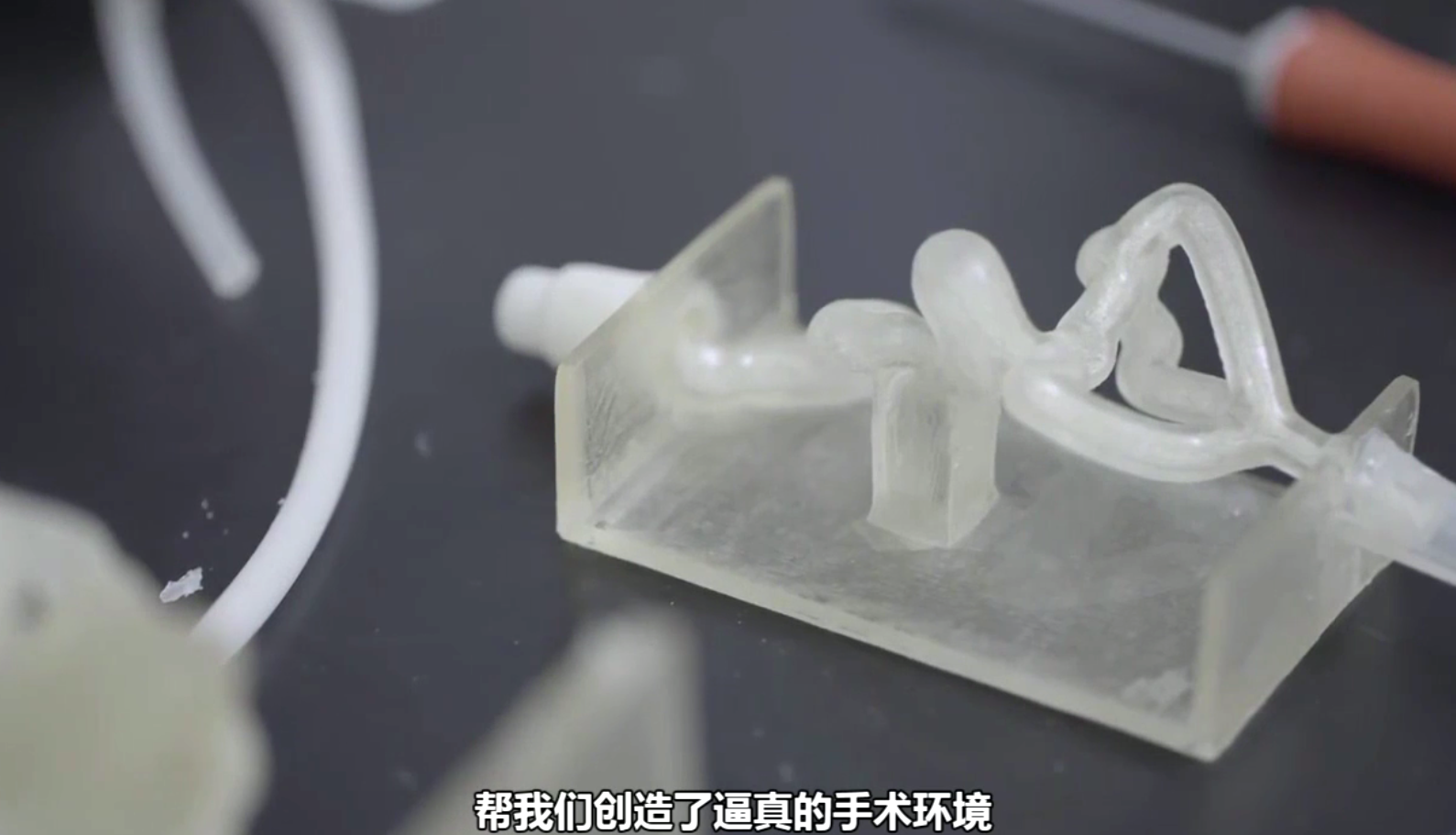 Teresa腦動(dòng)脈瘤術(shù)前規(guī)劃