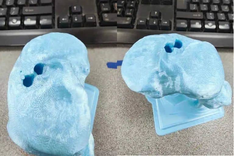 長沙市中醫(yī)院應(yīng)用3D打印技術(shù)制作百余例模型，助力精準醫(yī)療